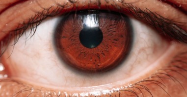 hypnose