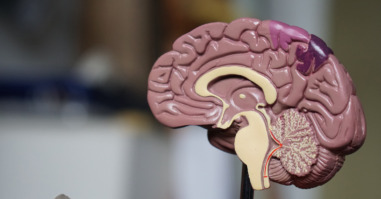 alzheimer-voorspelbaar-brein