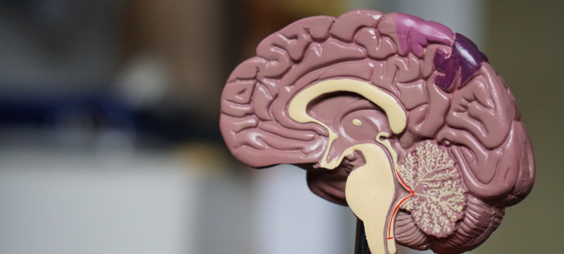 alzheimer-voorspelbaar-brein