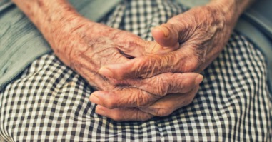 alzheimer