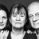 beeld_alzheimer